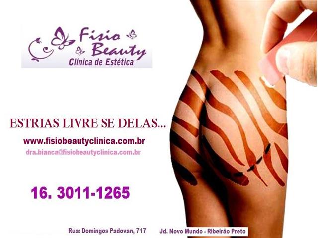 TRATAMENTO DE ESTRIAS E CELULITES EM RIBEIRAO PRETO - FISIO BEAUTY - SP