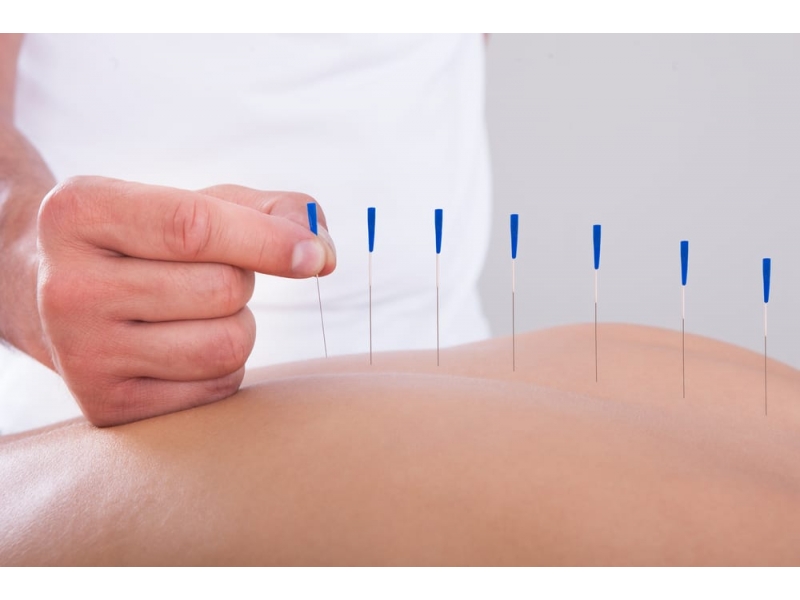 ACUPUNTURA E PILATES EM TREMEMBÉ - SP 